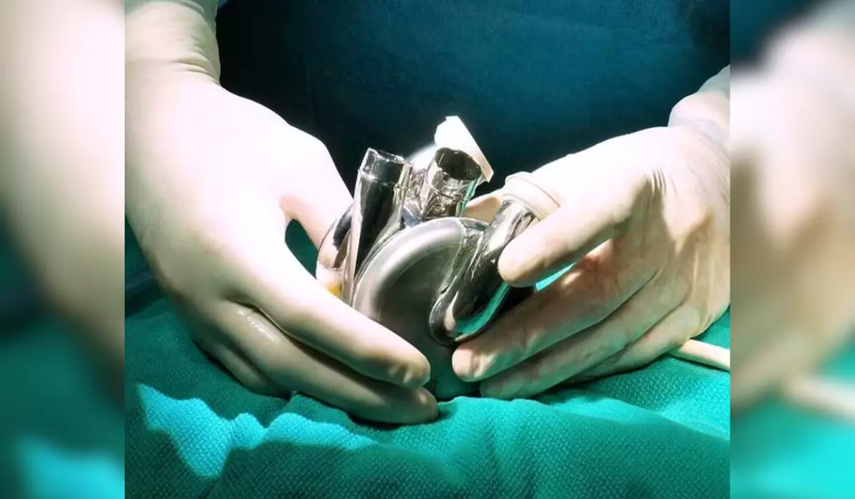 Primeiro coração artificial feito de titânio do mundo foi implantado com sucesso em um paciente humano e isso muda tudo!