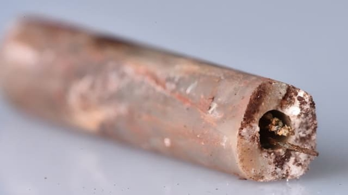 agujas de acupuntura