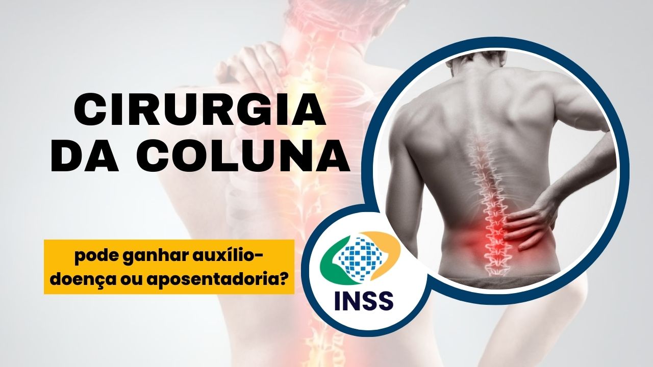 A cirurgia de coluna dá direito a auxílio-doença ou aposentadoria? Saiba o que é preciso para ter acesso aos benefícios do INSS.
