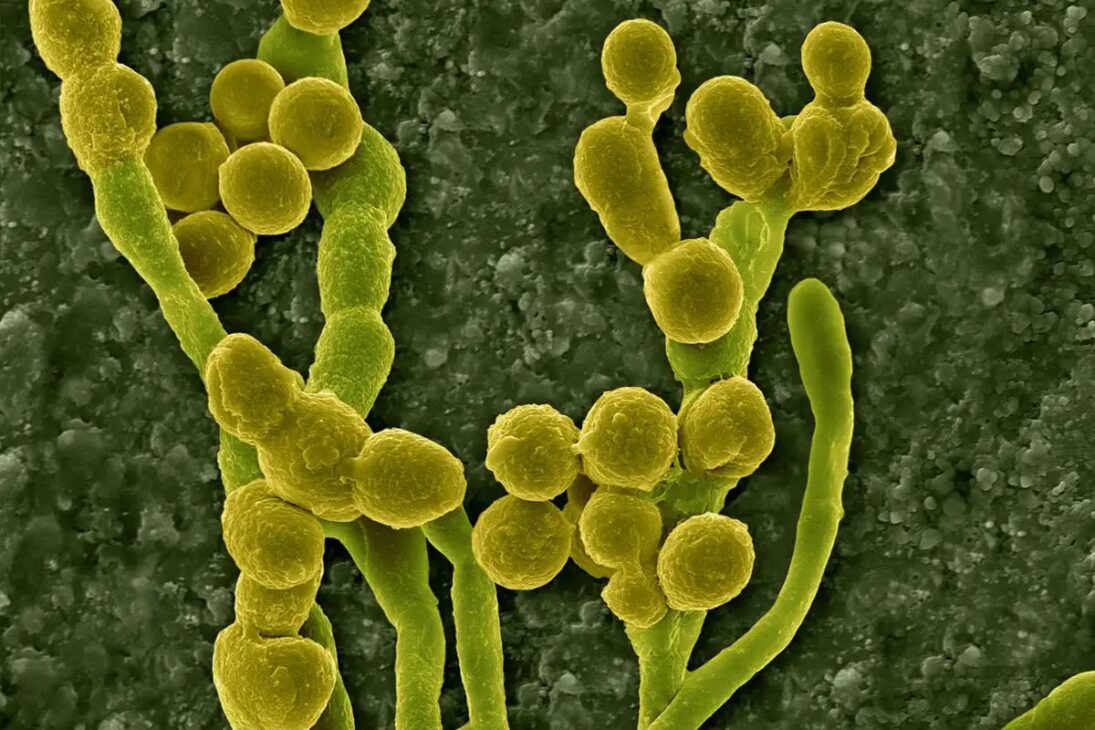 Fungos alienígenas descobertos em Chernobyl usam melanina para absorver radiação e podem proteger astronautas em Marte, segundo testes da NASA.