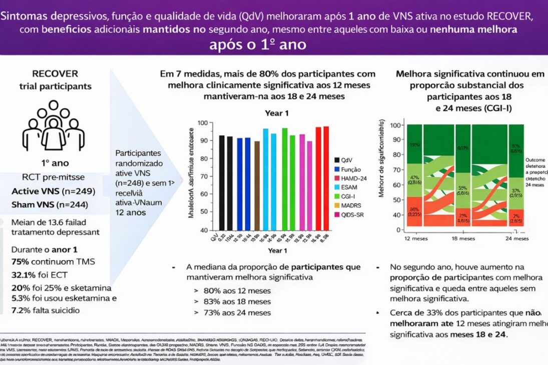 Depressão resistente: marca-passo neural com implante no nervo vago surge como novo tratamento.