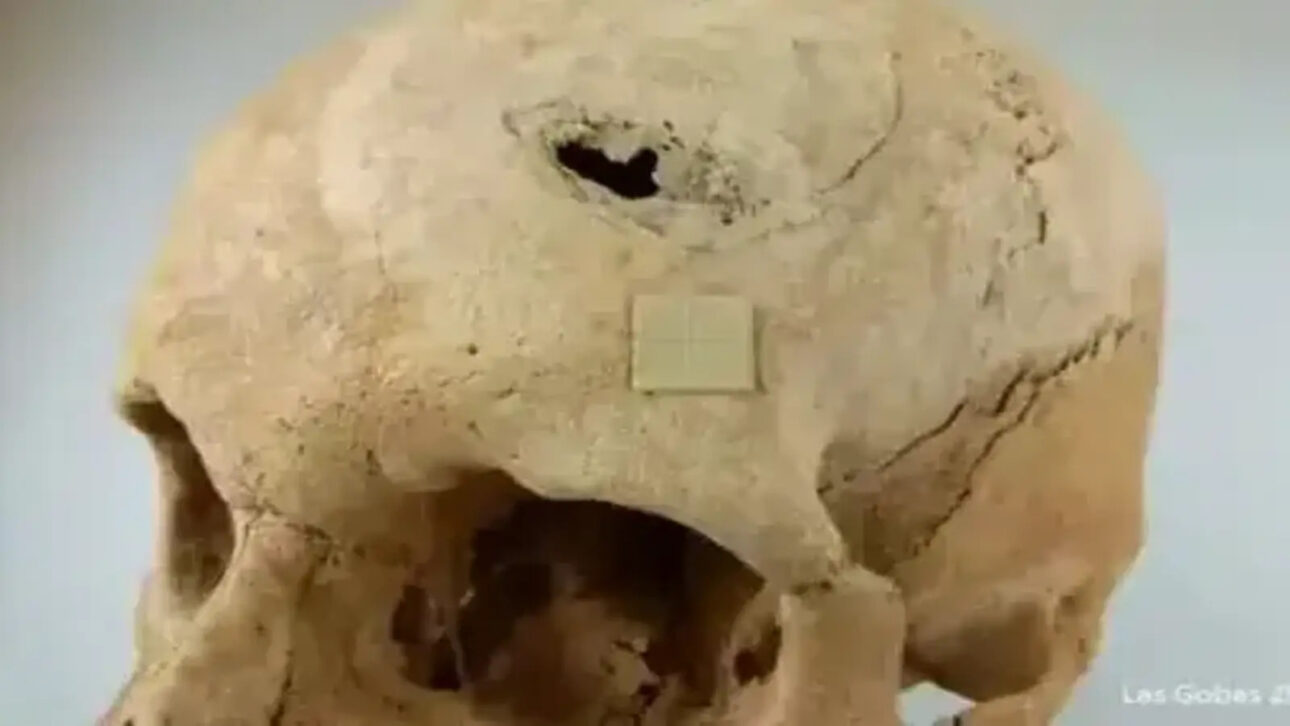 Analyzed human remains