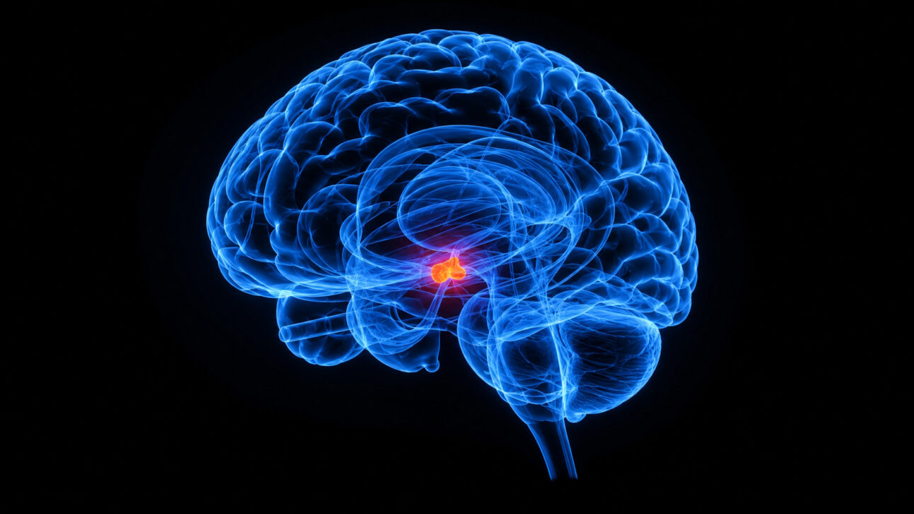 Representation of the human brain with the pituitary highlighted, the region where the tumor associated with Cushing's disease appeared.