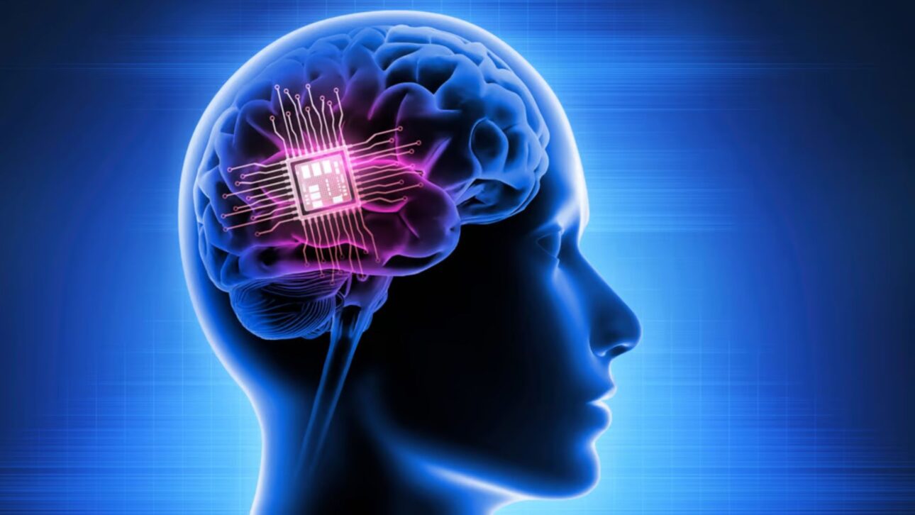 The cortical electrode arrays commonly used today, usually made of platinum or platinum-iridium alloys, offer excellent conductivity but are much more rigid than neural tissue. Photo: Shutterstock