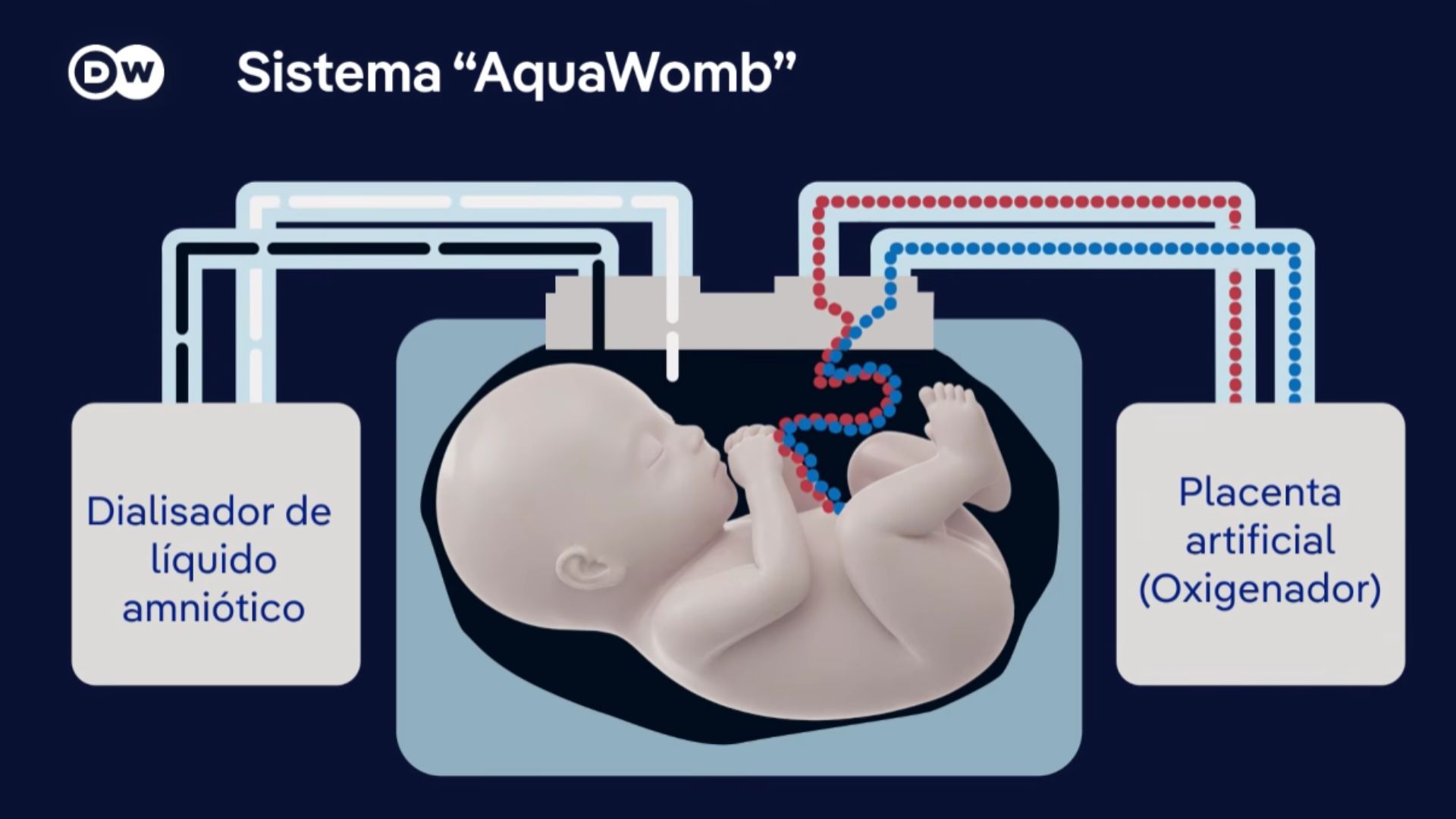 Scientists have developed an artificial womb that can keep premature babies alive outside the body Cientistas Criam Utero Artificial Capaz De Manter Bebes Prematuros Vivos Fora Do Corpo Humano E Agora Surge A Pergunta Que Ninguem Quer Responder 1