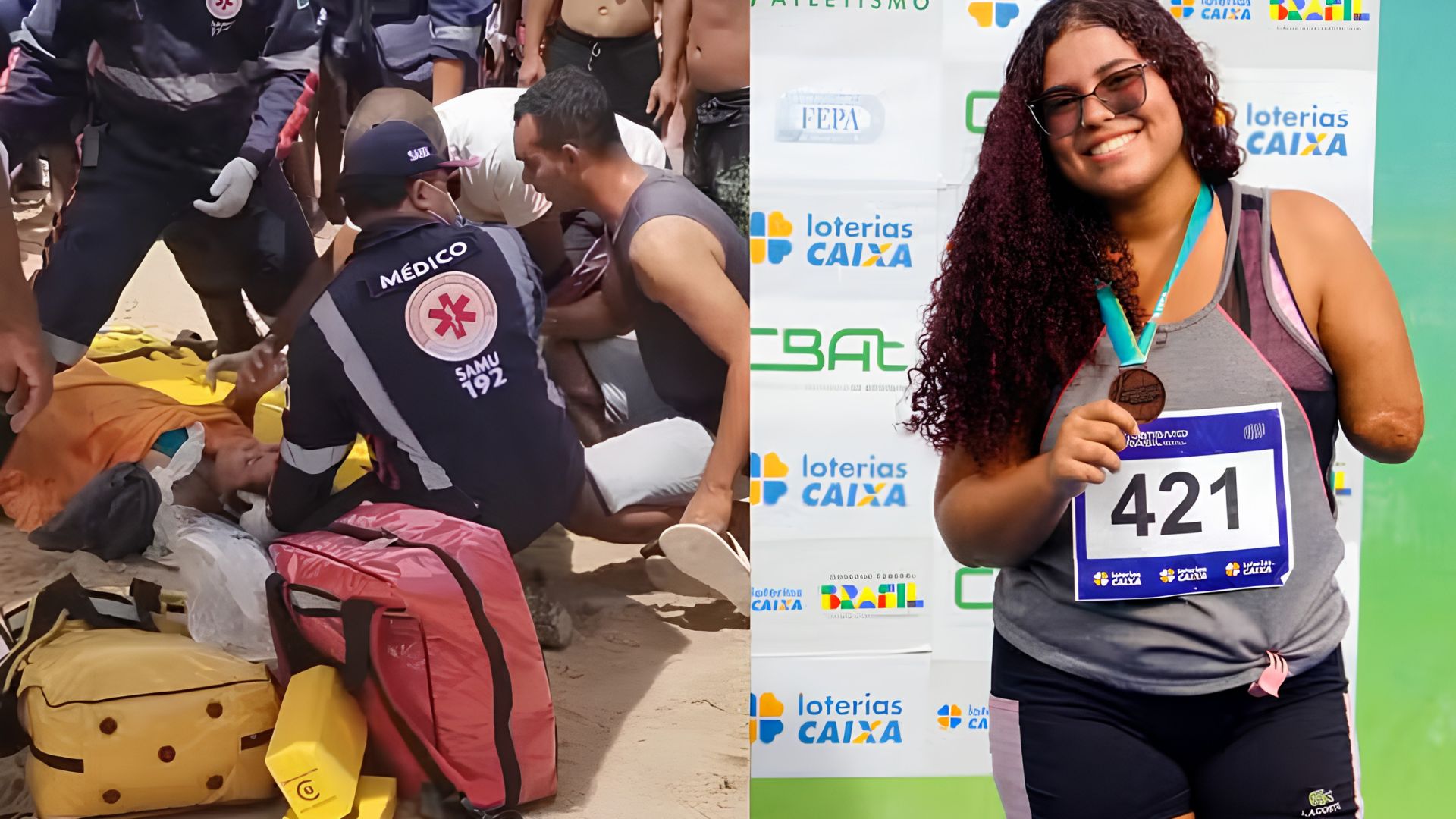 Justiça nega indenização a jovem que perdeu o braço em ataque de tubarão em Pernambuco