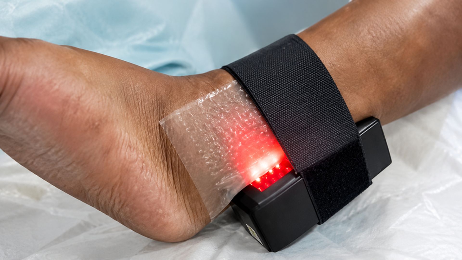 Na UnB, o Rapha é um dispositivo para pé diabético que une látex natural da seringueira e luz de LED para curar feridas e evitar amputações.