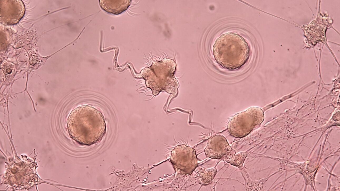 Anthrobots feitos com células humanas mostram como a bioengenharia transformou células da traqueia em robôs vivos microscópicos