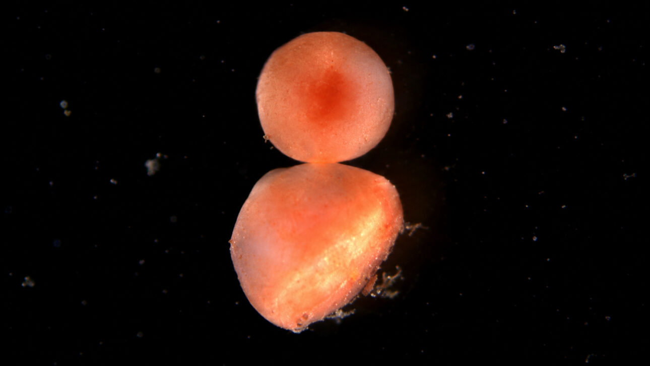 Imagem microscópica de fragmentos de tecido do pepino-do-mar Psolus fabricii, estrutura estudada por cientistas após permanecer funcional por mais de três anos fora do organismo original.