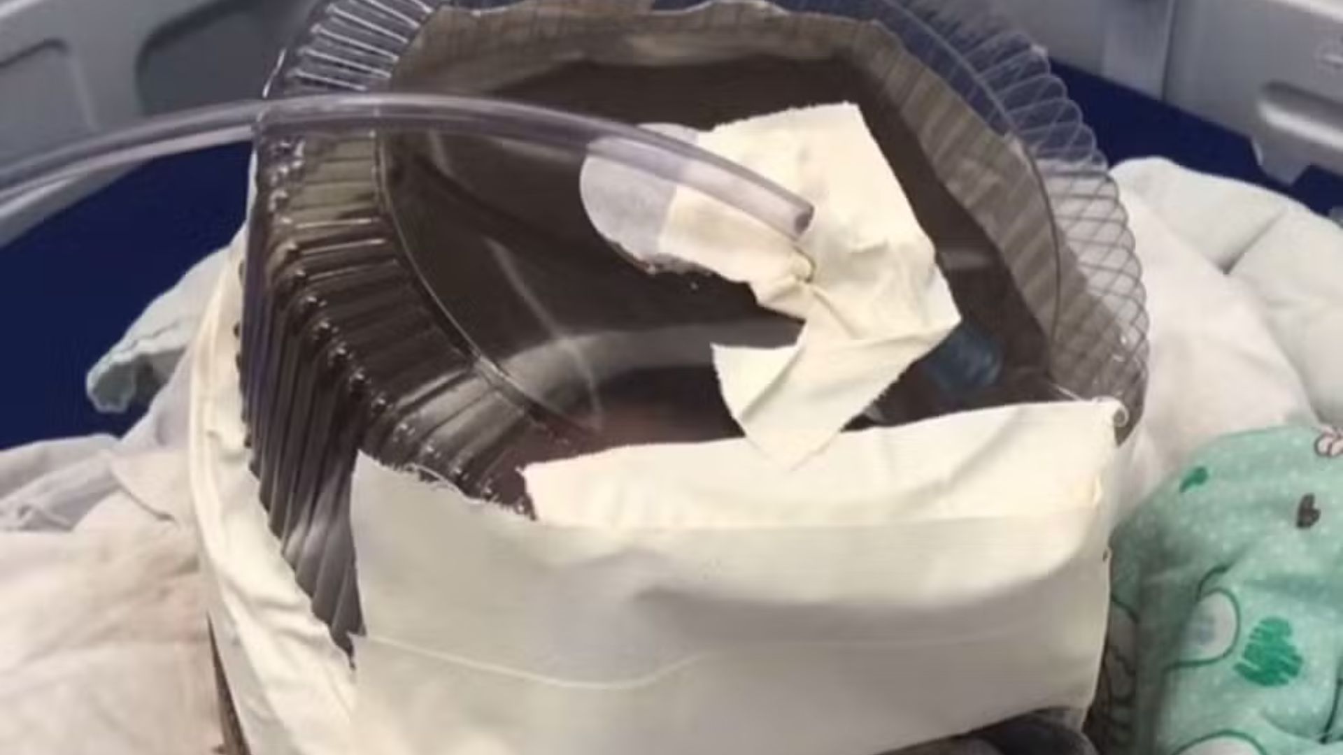 Medica usou embalagem de bolo como capacete de oxigenio para salvar bebe de 3 meses em hospital sem equipamento no RN. Improviso segurou o quadro por 4 horas.