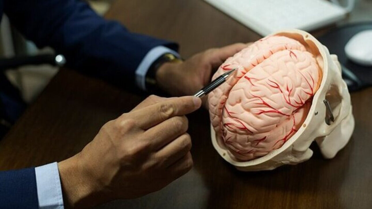 Irã desarrolla prototipo de cerebro artificial con células nerviosas humanas vivas, tecnología que puede aumentar la velocidad de procesamiento y reducir el consumo de energía hasta un millón de veces