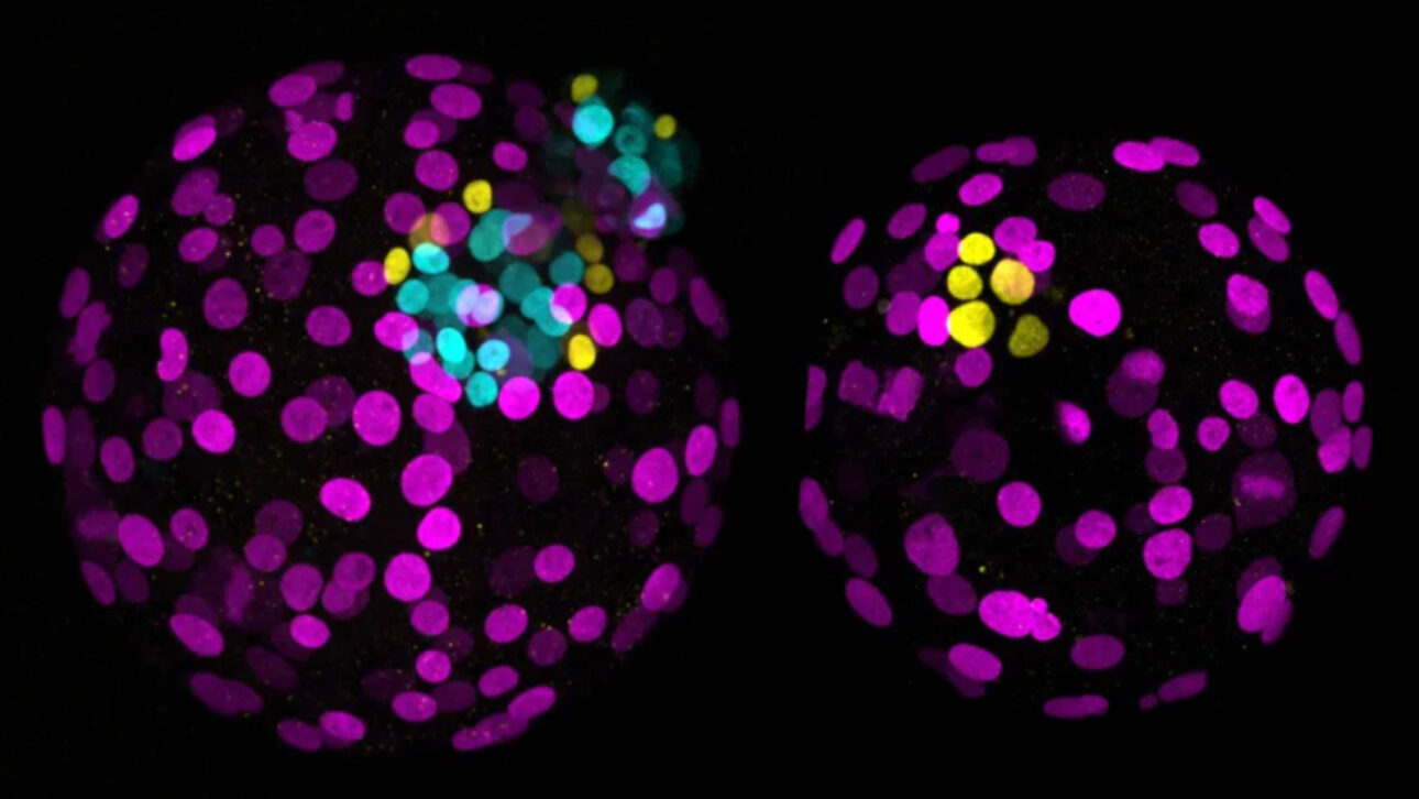 Cientistas avançam na criação de bebês geneticamente modificados ao alterar o DNA de embriões humanos com menos danos, mas mosaicismo e mutações indesejadas ainda preocupam especialistas