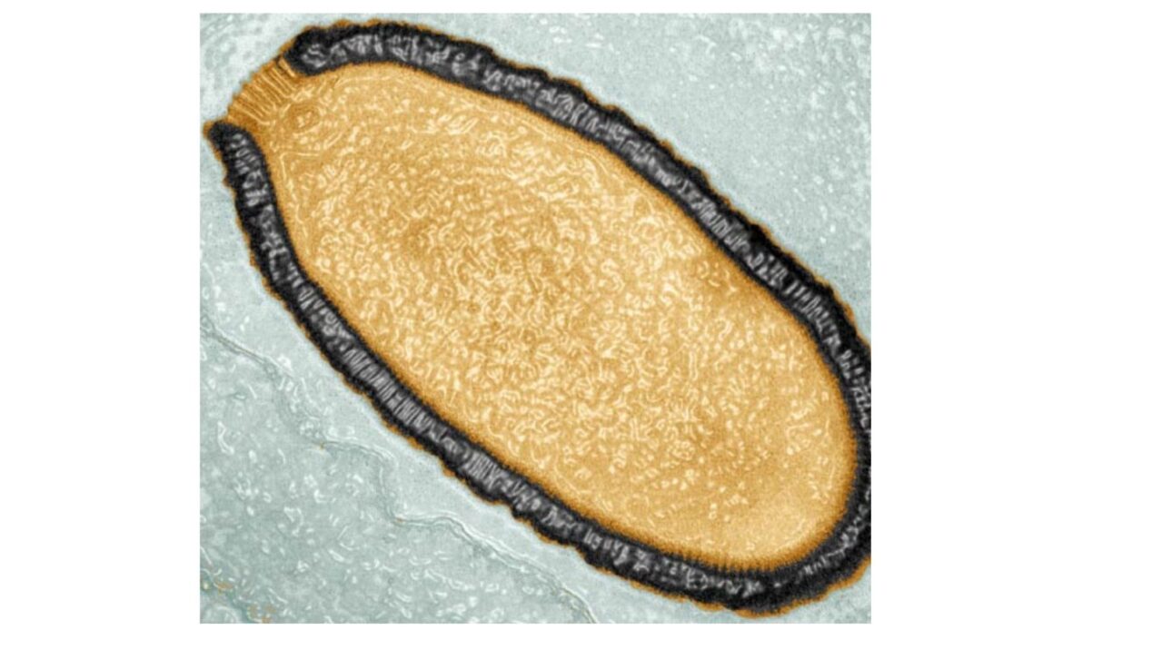 Pithovirus sibericum . Crédito da imagem: Julia Bartoli / Chantal Abergel / IGS / CNRS / AMU.