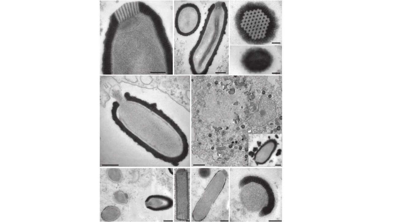Imagens de microscopia eletrônica do ciclo de replicação do Pithovirus em A. castellanii. (A) Ápice da partícula do Pithovirus mostrando sua estrutura única, composta por faixas espaçadas em 15 nm, membranas enroladas abaixo e a membrana interna. (B) Duas vistas perpendiculares das partículas do Pithovirus (seções transversal e longitudinal). As partículas são envolvidas por um envelope de 60 nm de espessura, composto por faixas paralelas espaçadas em 10 nm. Uma membrana lipídica envolve um interior homogêneo onde uma estrutura tubular é observada episodicamente, mas de forma reprodutível (ponta de seta). (C) Vista superior da estrutura revelando um arranjo hexagonal semelhante a um favo de mel. (D) Vista inferior da partícula mostrando a organização estriada do envelope. (E) Uma partícula de Pithovirus aberta no vacúolo do hospedeiro. Partes da estrutura expelida são visíveis (setas pretas) e a membrana interna da partícula (ponta de seta preta) parece pronta para se fundir com a membrana do vacúolo. (F) Vírus em maturação em um estágio tardio da infecção. Estruturas compostas por listras, pedaços de cortiça e material denso se acumulam (ponta de seta branca) na periferia da fábrica de vírions (VF). Essas estruturas podem conter blocos de construção de partículas pré-montados (Fig. S1). O núcleo da célula (N) é visível. (G) Detalhe destacando um estágio tardio da maturação do vírion com estruturas globulares estriadas se acumulando na periferia do vírion. (H) Vários estágios de montagem da partícula na mesma célula. (I) Partícula retangular incompletamente montada, sem seu envelope espesso. A cortiça estriada já é visível. (J) Em um estágio posterior, a partícula adota sua forma arredondada final enquanto seu envelope engrossa. (K) Vista ortogonal de um vírion imaturo mostrando o envelope em processo de envolvimento da partícula.