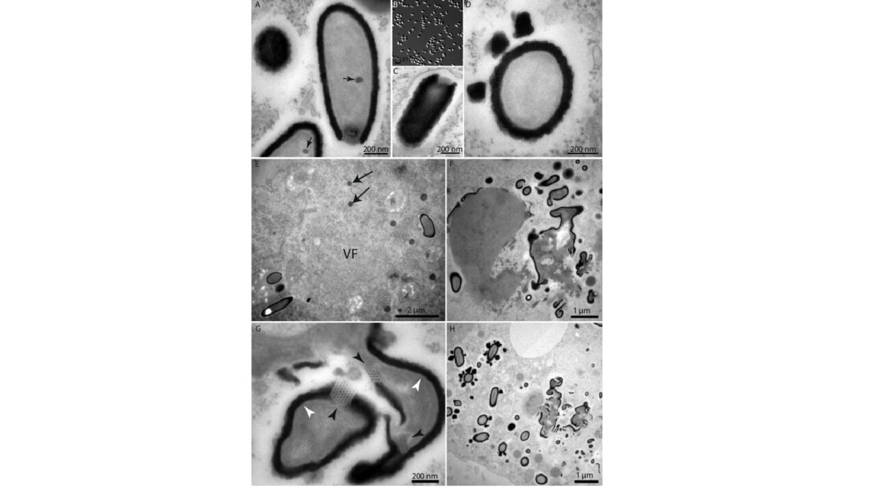 Figura S1. Imagens de microscopia eletrônica de partículas de Pithovirus e células de Acanthamoeba infectadas. (A) Cortes ultrafinos de partículas de Pithovirus mostrando uma esfera eletrodensa semelhante com 50 nm de diâmetro (setas pretas). (B) Imagem de microscopia óptica de partículas de Pithovirus purificadas. (C) Corte transversal do envelope do Pithovirus mostrando sua organização estriada. A cortiça apical também é visível. (D) Estruturas globulares estriadas que participam da maturação do envelope na periferia de um vírion. (E) A fábrica de vírions (FV) aparece como uma área clara desprovida de estruturas subcelulares citoplasmáticas. Vesículas densas se acumulam na periferia da FV (setas pretas). (F) Áreas intracitoplasmáticas eletrodensas e não estruturadas. (G) Vista ampliada mostrando a natureza complexa dessas áreas compostas por uma variedade de envelopes estriados (pontas de seta brancas), fragmentos de cortiça (pontas de seta pretas) e material difuso que lembra o interior das partículas maduras. (H) Estágio posterior da maturação do vírion dentro de um VF. Partículas maduras coexistem com vírions em maturação, circundados por estruturas globulares listradas (vista ampliada na Fig. 1F).