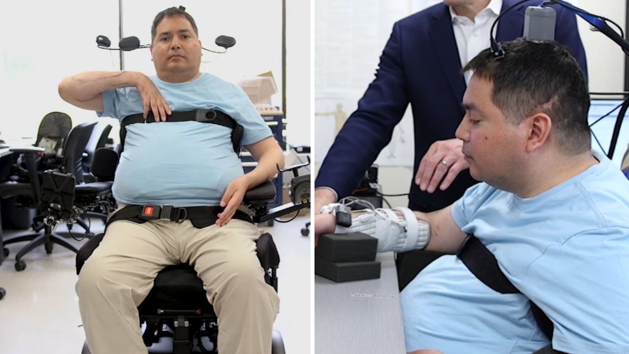 Homem com tetraplegia volta a alimentar-se, beber em copo e sentir o toque da irmã após cirurgia de 15 horas para instalar implante cerebral com inteligência artificial, sistema que (3)
