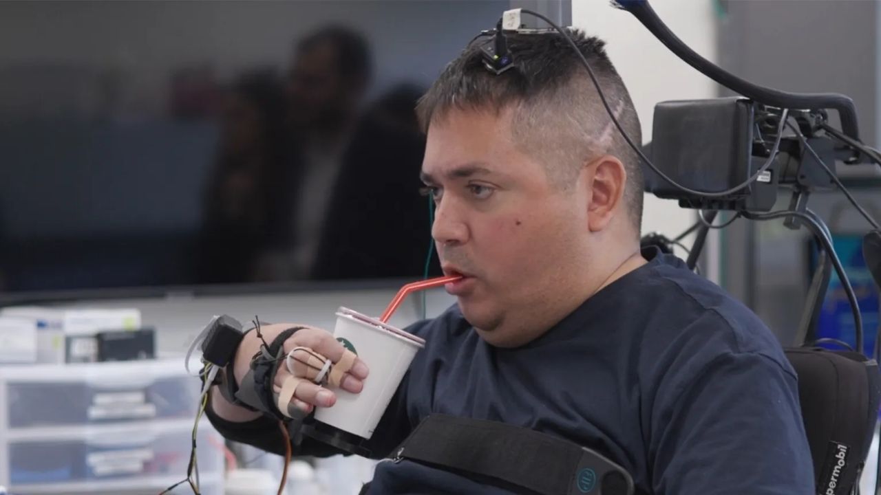 Implante cerebral com inteligência artificial usa dupla ponte neural para contornar lesão medular e devolver movimentos a homem com tetraplegia.
