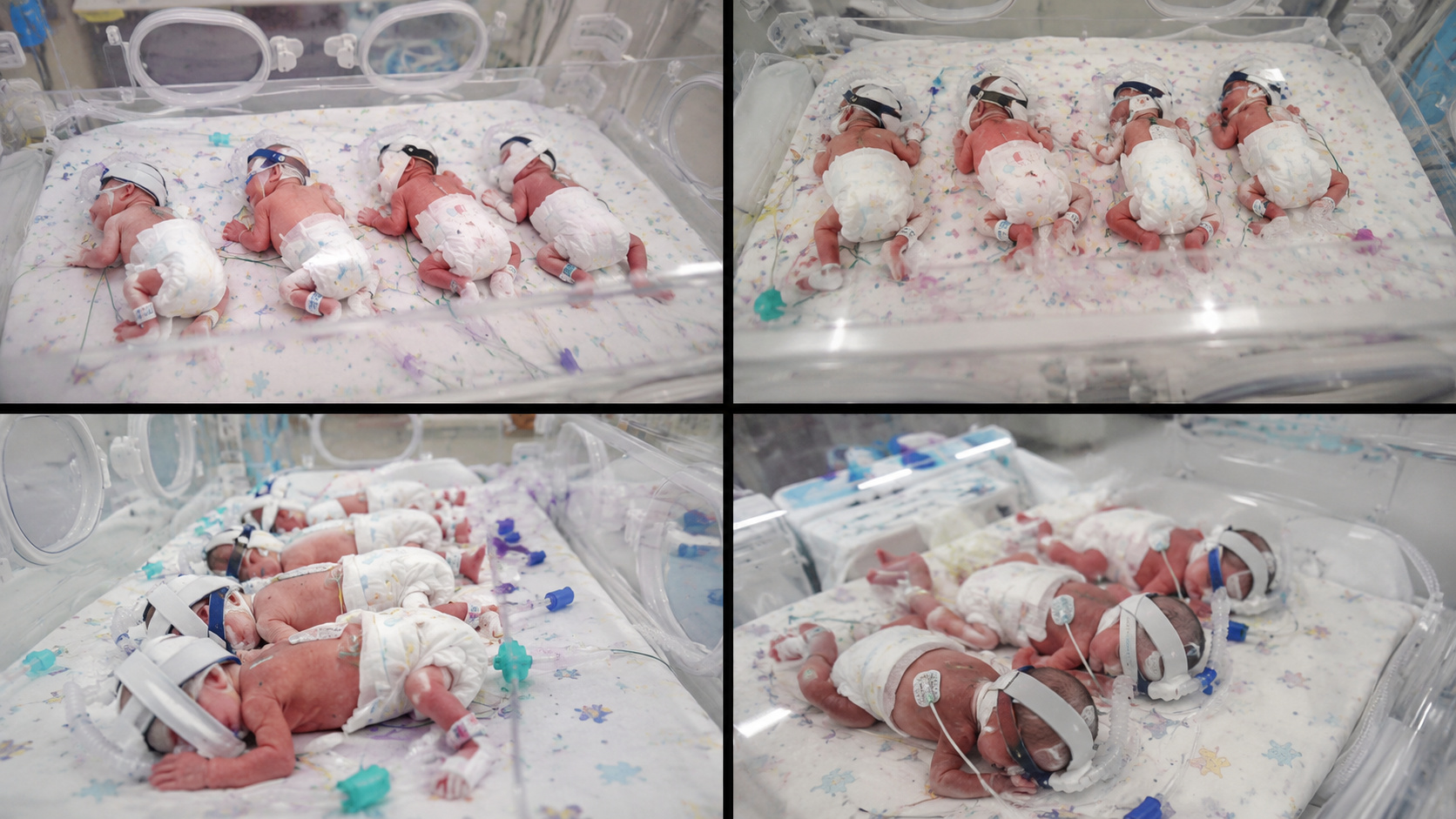 Colagem com quatro imagens de bebês prematuros em incubadoras na UTI neonatal de um hospital, ilustrando o raro nascimento de quadrigêmeas idênticas após uma gravidez natural de altíssimo risco na Austrália.