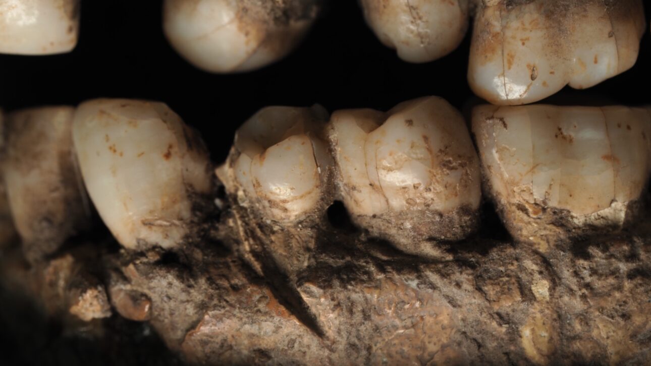 Homo sapiens de 100 mil anos foi esfaqueado no rosto em caverna de Israel e virou o registro mais antigo de violência humana; entenda o caso Qafzeh 25.