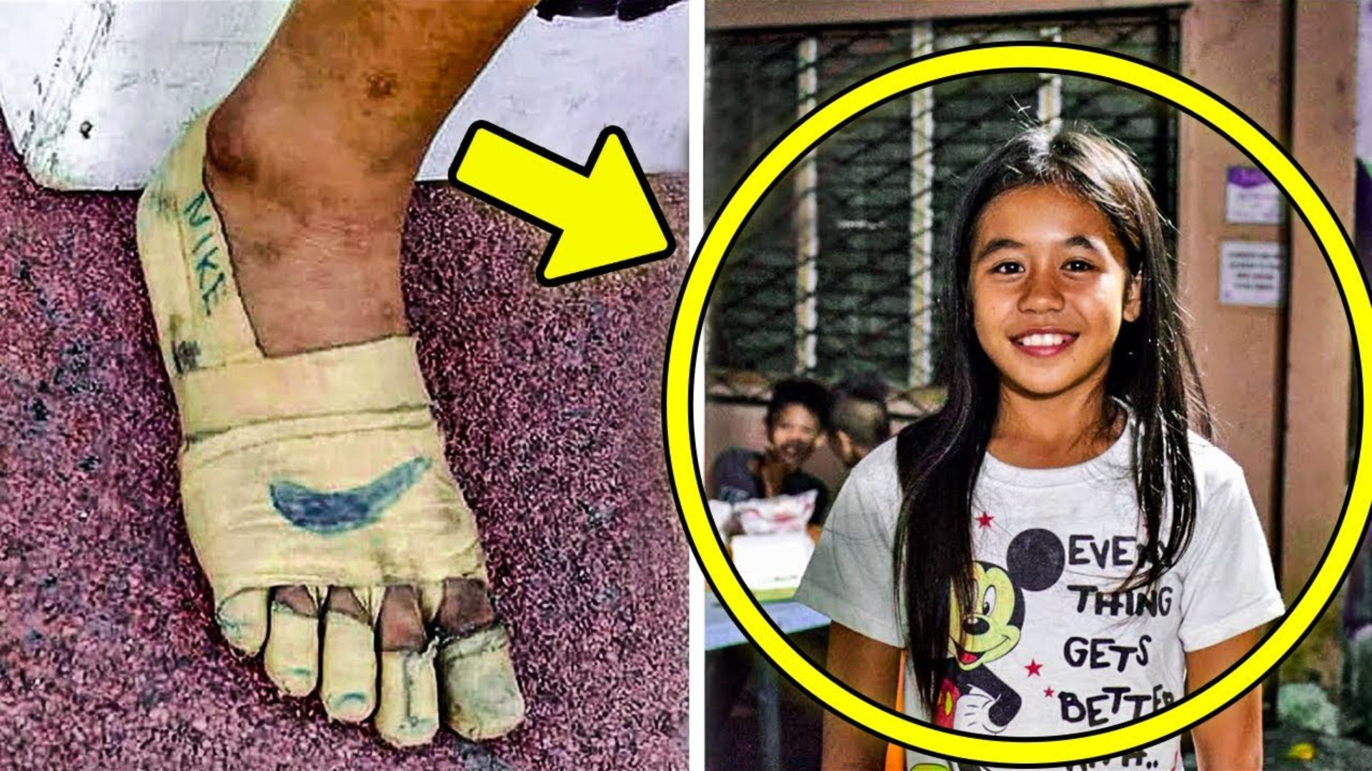 Menina de 11 anos correu descalça com os pés cobertos por esparadrapo porque não tinha tênis