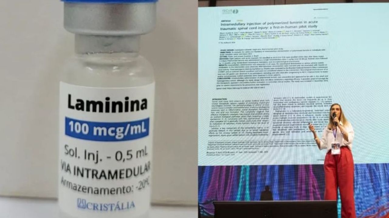 Primeiro estudo em humanos com polilaminina brasileira mostra melhora neurológica em pacientes com lesão medular completa