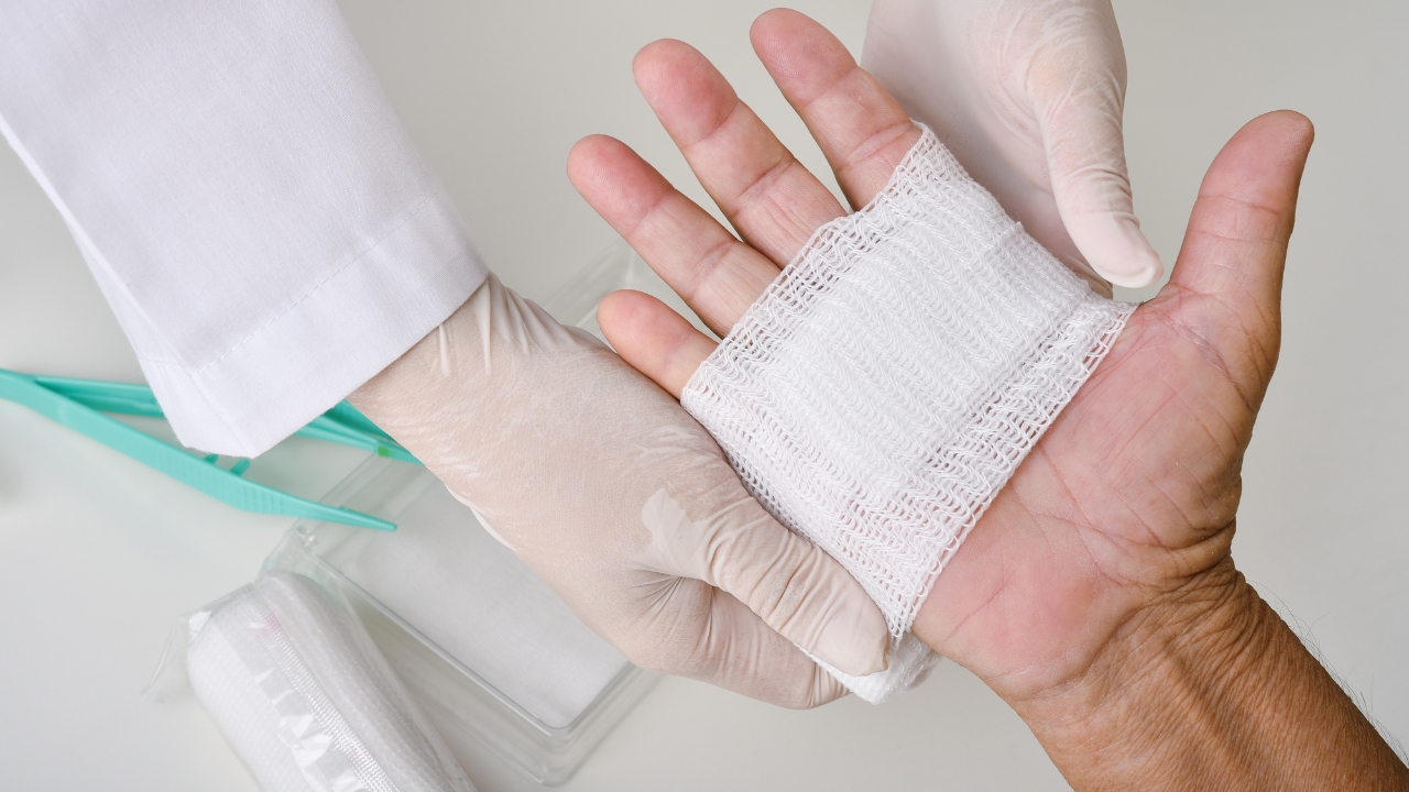 Novo curativo captura proteínas do próprio paciente e as libera durante o reparo, acelerando a cicatrização com doses menores.
