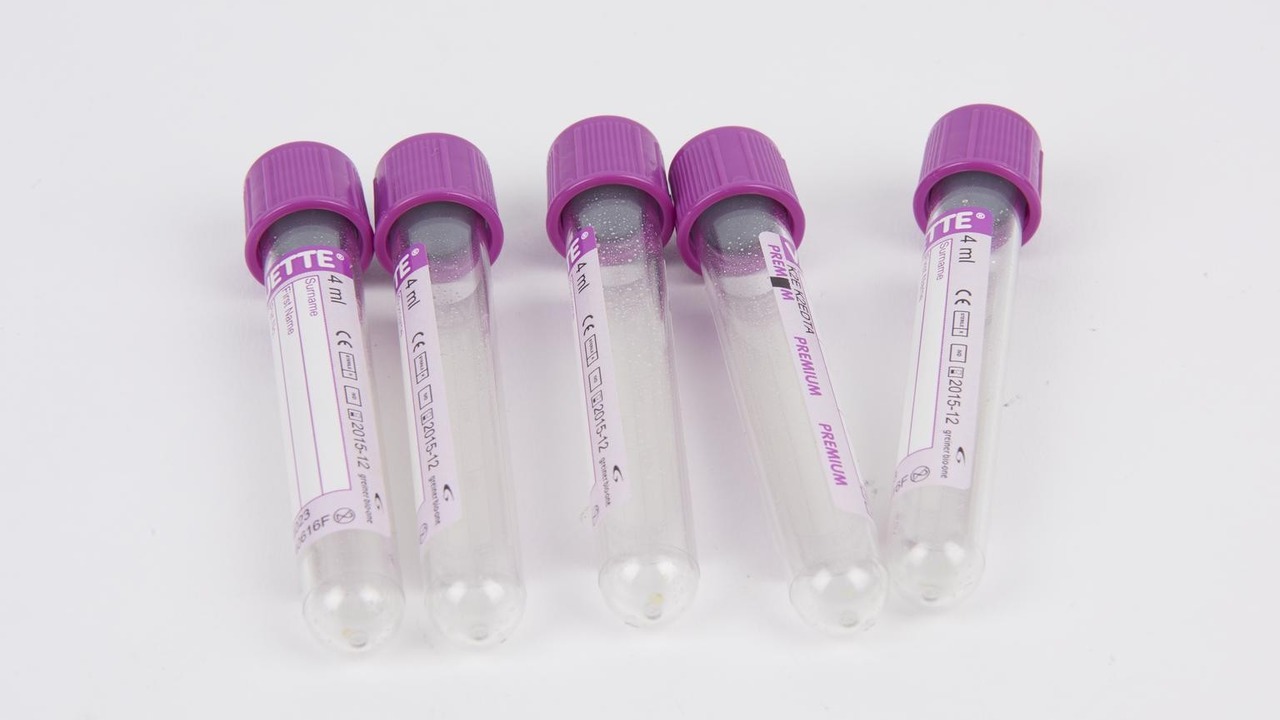 Tubos de coleta de sangue com tampas roxas sobre bancada de laboratório clínico